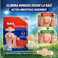 ¡Nuevo! DermaPatch™ Parche Antifúngico para Hongo