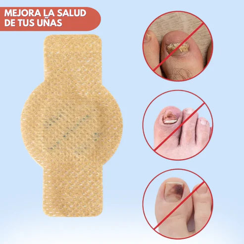¡Nuevo! DermaPatch™ Parche Antifúngico para Hongo