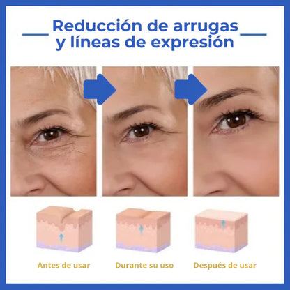 ¡Nuevo! DermaLuxe 21D® - Serum de Botox | Transformación en Solo 21 Días