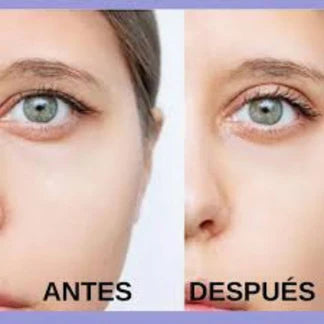 ¡Nueva! MiraBella™ Lifting de Párpados sin Cirugía + eBook de Maquillaje Gratis